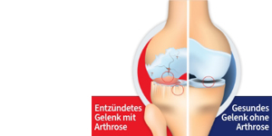 GELENCIUM arthro mixture, 2X100 ml