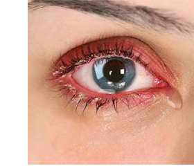 EVOTEARS Omega eye drops, 3 ml