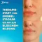 ZOVIRAX Cold Sore Cream, 2 g