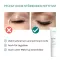 BENEVI Neutral Eyelid Cream, 15 ml