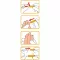 WELLION Safetylancets 28 G safety enamels, 25 pcs