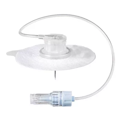 AMBIX Intrastick Safe 20 Gx20 mm pressure-resistant, 1 pc