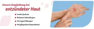 Instructions for use for FeniHydrocort cream 0.5%, hydrocortisone 5 mg/g, effective for skin inflammation, 30 g - 6