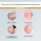 EndWarts® CLASSIC solution, 3 ml
