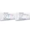 CLEARBLUE Pregnancy test early detection, 2 pcs
