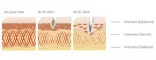 Instructions for use for A4 Impulse ampoules, 28 pcs - 5