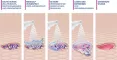 Instructions for use for MediGel® wound cleaning spray, 50 ml - 6