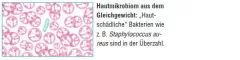 Instructions for use for AKTIVADERM ND Neurodermatitis skin treatment active probiotics, 250 g - 2