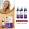 MINOXIDIL DoppelherzPharma 20 mg/ml solution for women, 3X60 ml